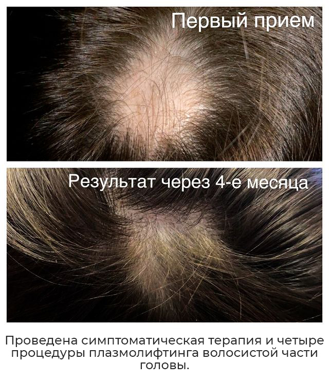 Лечение волос фото 1
